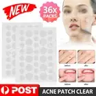 36Pcs Dermopatchy Acne & Skin Tags Pimple Remover Patch Removal Facial Care Spot
