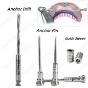 ∅1.5 Dental Anchor Drill Guided Anchor Pins DSG Digital Guide Scanner Sleeves