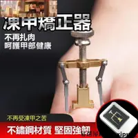 在飛比找蝦皮購物優惠-熱銷~不鏽鋼凍甲矯正器 美甲腳趾卷甲 嵌甲矯正器 甲溝炎 糾