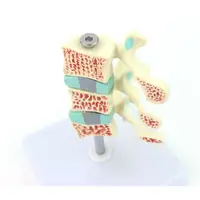 在飛比找蝦皮購物優惠-(ENOVO-057) 人體骨質疏鬆癥模型 椎間盤人體腰椎模