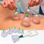 1 Sets 6 Cups Hijama Cupping Set With Pump Vacuum Suction Cups For Body Cellulite Cupping Massage Back Pain Relief