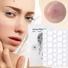 Skin Tag Remover Acne Pimple Patch Removal Facial Care Spot Plaster Blemish