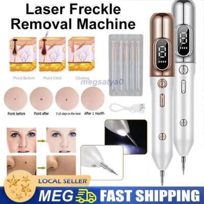 Laser Freckle Removal Machine Skin Dark Spot Removal Face Wart Mole Remover Pen.