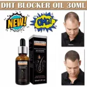 Organic DHT Blocker Oil for Hair Loss, Hair Growth, Split Ends, DHT Blocker Oil