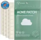 Acne Pimple Patches, Hydrocolloid Acne Patches with Tea Tree Oil,Salicylic Acid