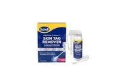 Scholl Freeze Away Skin Tag Remover - Cryogenic skin tag removal solution safe for in -home application Clinically proven to remove skin tags in as little as one treatment 12 Treatments in box