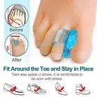 2pcs Silicone Gel Toe Spacer Separator Straightener Spreader Bunion Pain Relieio