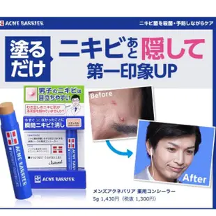 【ACNE BARRIER】男性遮瑕膏(專為男性膚色設計 男用遮瑕兩色可選 疤痕說掰掰)