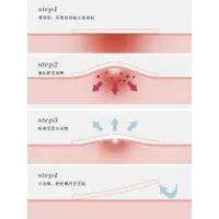 在飛比找ETMall東森購物網優惠-韓國正品隱形可上妝痘痘貼