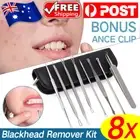 8pcs Blackhead Remover Extractor Tool Pimple Blemish Popper Comedone Kit Clip AU