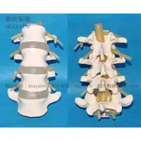 在飛比找蝦皮購物優惠-(MD-B_1473)腰椎 脊椎 大型四節腰椎模型 人骨模型
