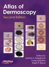 在飛比找三民網路書店優惠-Atlas of Dermoscopy