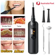 Electric Ultrasonic Tooth Cleaner LED Vibrating Dental Scaler Calculus Remover