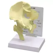 Hip Bone Joint GPI Anatomical Model LFA # 1260. Make Us an Offer!