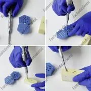 Dental GBR Bone TAC Pins Gun Tacks Membrane Auto Guide Curved Tacker/Box
