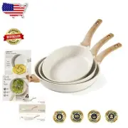 Nonstick Granite Frying Pan Set - PFOA Free Cookware in 3 Versatile Sizes
