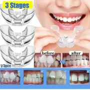 Dental Orthodontic Teeth Corrector Silicone Braces Retainer Straighten Tools Teeth Capped for Adults