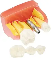 JECOMPRIS 1pc Study Model Realistic Teeth Model for Education and Patient Communication for Teaching and Demonstration