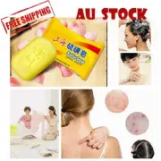 36x Sulfur Soap 85g Sulphur Soaps Bacteria Acne Eczema Antiseptic Medicated AU