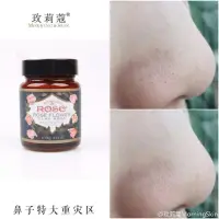 在飛比找蝦皮購物優惠-粉刺專家～花泥面膜，清鬆去除粉刺，收縮