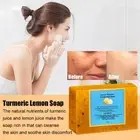 100g Lemon Turmeric Kojic Acid Soap Bar, TurmericFace and Body Soaps New