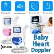 Prenatal Heart Beat LCD with Probe Doppler Fetal Monitor Baby Backlight 2MHz