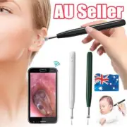 Wireless Ear Wax Remover Cleaner Tool Endoscope Spoon Pick 1080P HD Camera MQ