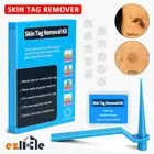 Skin Tag Remover Kit for Fast & Effective Skin Tag Removal AU