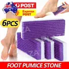 6xFoot Pumice Stone Exfoliator File Scrubber Sponge Pedicure Tool Callus Remover