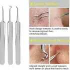 8pcs Blackhead Remover Tool Kit Pimple Blemish Skin Care Acne Pimple Extractors