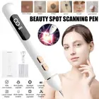 Laser Plasma Pen Freckle Remover Machine Skin Mole Wart Dark Spot Removal