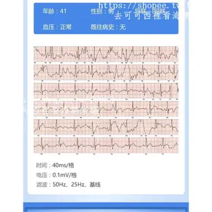 ✅✅✅美國智能手環監測儀血壓心率心電圖男女多功能 健康睡眠心律報警提醒手表運動計步器醫療級老人防水彩屏