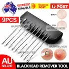 9PCS Blackhead Remover Extractor Tool Pimple Blemish Popper Comedone Kit Clip AU