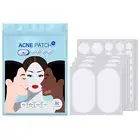 80PCS Acne Patch Pimple Skin Tag Spot Patches Spot Treatment HydrocolloidDots~