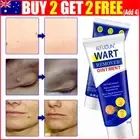 Skin Tag Remover Ointment Natural Fast Herbal Wart Removal Removing Cream 20g