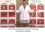 SMALL SIZE VENEERS INSTANT SMILE BEAUTIFUL PERFECT TEETH dentures MAKEOVER
