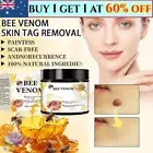 Bee Venom Skin Tag Removal Treatment Cream For Body Care Mole Corn Skin Wart AUS