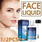 Fast Skin Tag Wart Acne Remover Liquid Instant Treatment Safe Removal Face