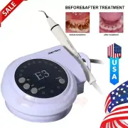 Portable Dental Piezon Ultrasonic Scaler fit Cavitron EMS Handpiece Tips Tube