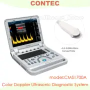 CONTEC 15"LED monitor Color Doppler Portable Ultrasound with Micro convex probe