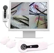 HUVIOVED 15 Inch LCD Screen Digital Skin Detector - Digital Skin Analyzer/Hair Facial Skin Detector for Home Salon - Four Picture Comparison