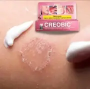5 x Creobic Scabies Treatment Cream Ringworm Parasites Itching Anti Fungus