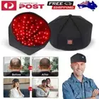 Red Light Therapy Cap LED Laser Hair Growth Hat Loss Treatment Scalp Care 660Nm