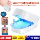 Nail Fungus Laser Device Light Therapy Onychomycosis Toes Treatment Device 910nm
