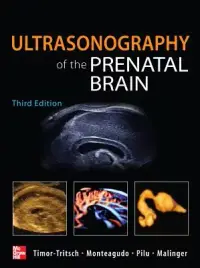 在飛比找博客來優惠-Ultrasonography of the Prenata