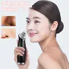 Cleanser Removes Blackheads Blackhead Removal Tool with Results for Acne