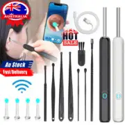 Wireless WiFi HD Ear Spoon Cleaner Otoscope Endoscope Ear Wax Remover Camera KRO
