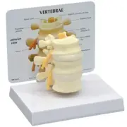 Lumbar Vertebrae 3-pc L2- L4 GPI Model LFA #1500 Make Us an Offer! SEE VIDEO