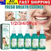 1-5Pcs Bad Breath Removing Drops - Mint Fresh Breath Professional Best 30ml