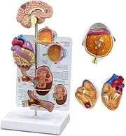 CHROX PVC Hypertension Model, Miniature Brain, Eyes, Heart, Kidneys and Arteries Models, Set with Anatomy of The Human Body, Reproduction of A Hypertension Model